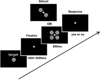 Prediction of Facial Emotion Recognition Ability in Patients With First-Episode Schizophrenia Using Amplitude of Low-Frequency Fluctuation-Based Support Vector Regression Model